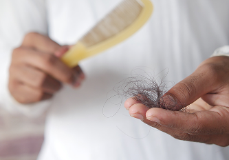 I Started Losing Clumps of Hair at 28. Here's Every Reason Why It Happens, and What Actually Helped.